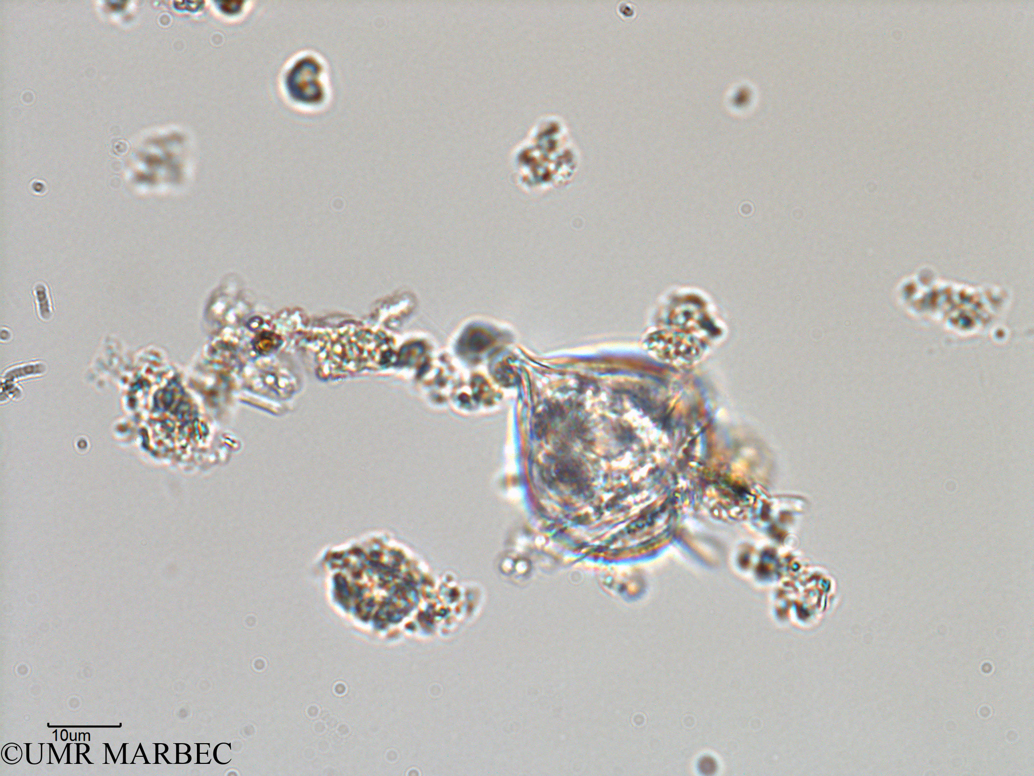 phyto/Bizerte/bizerte_lagoon/RISCO February 2015/Protoperidinium sp31 (ancien Lagune_T1-C-Protoperidinium sp31 -7).tif(copy).jpg